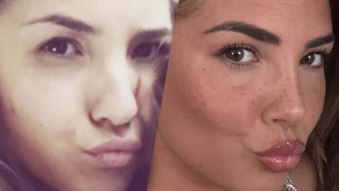 martina-de-ioannon-chirurgia-prima-dopo-che-si-e-rifatta.jpg